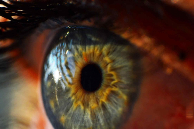 eye